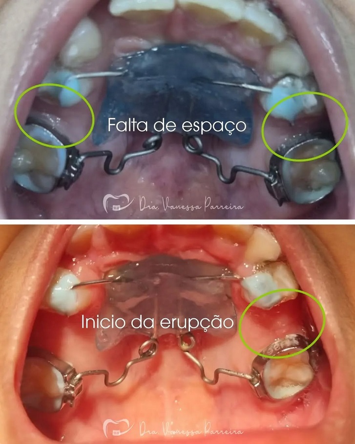 aparelho dentário em miguel couto