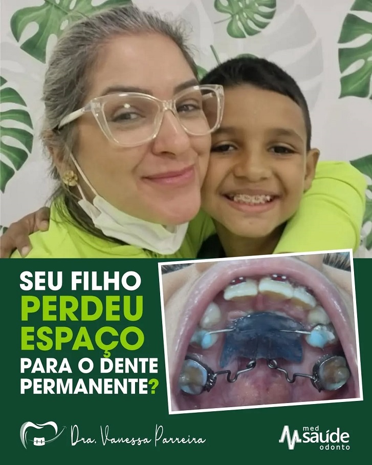 colocação de aparelho dentário